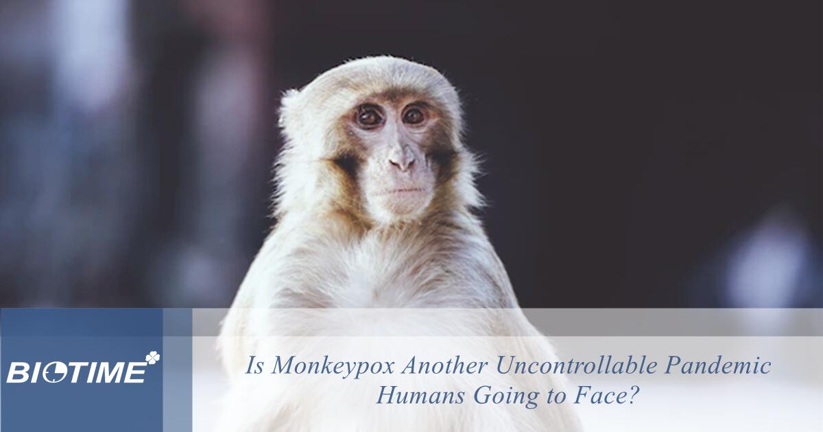 Является ли оспа обезьян еще одной неконтролируемой пандемией, с которой столкнется человечество?
